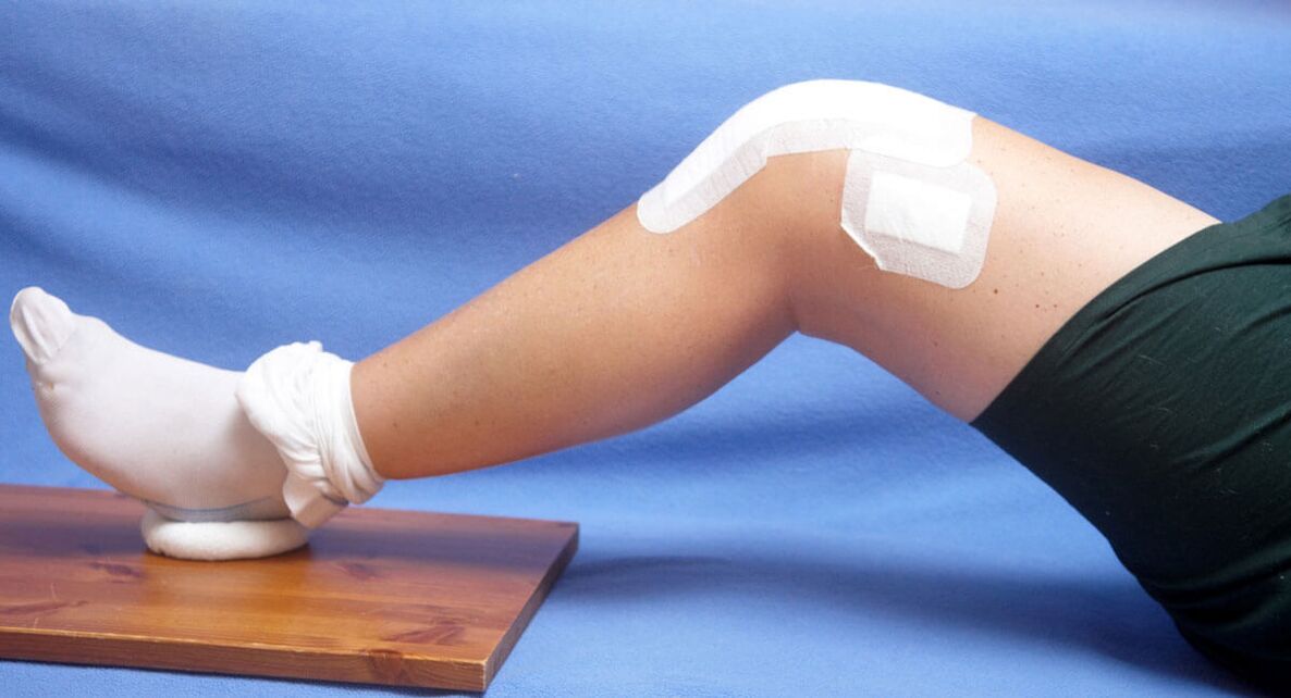 Lesione al ginocchio come causa di artrosi