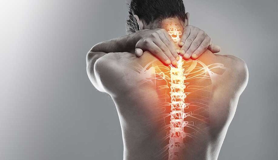 Osteocondrosi del collo