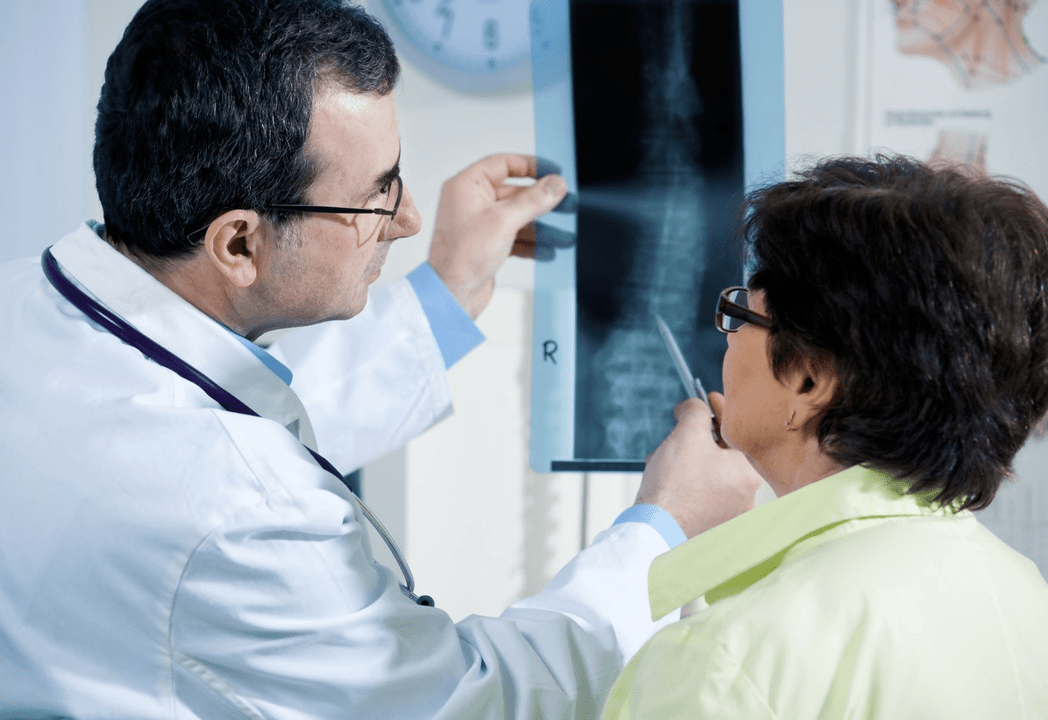 Un neurologo diagnostica l'osteocondrosi utilizzando una radiografia della colonna vertebrale