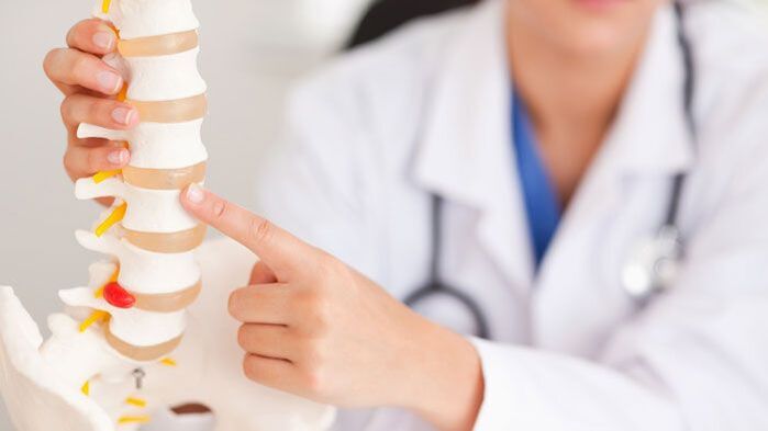 Spiegazione dell'osteocondrosi lombare utilizzando un modello della colonna vertebrale